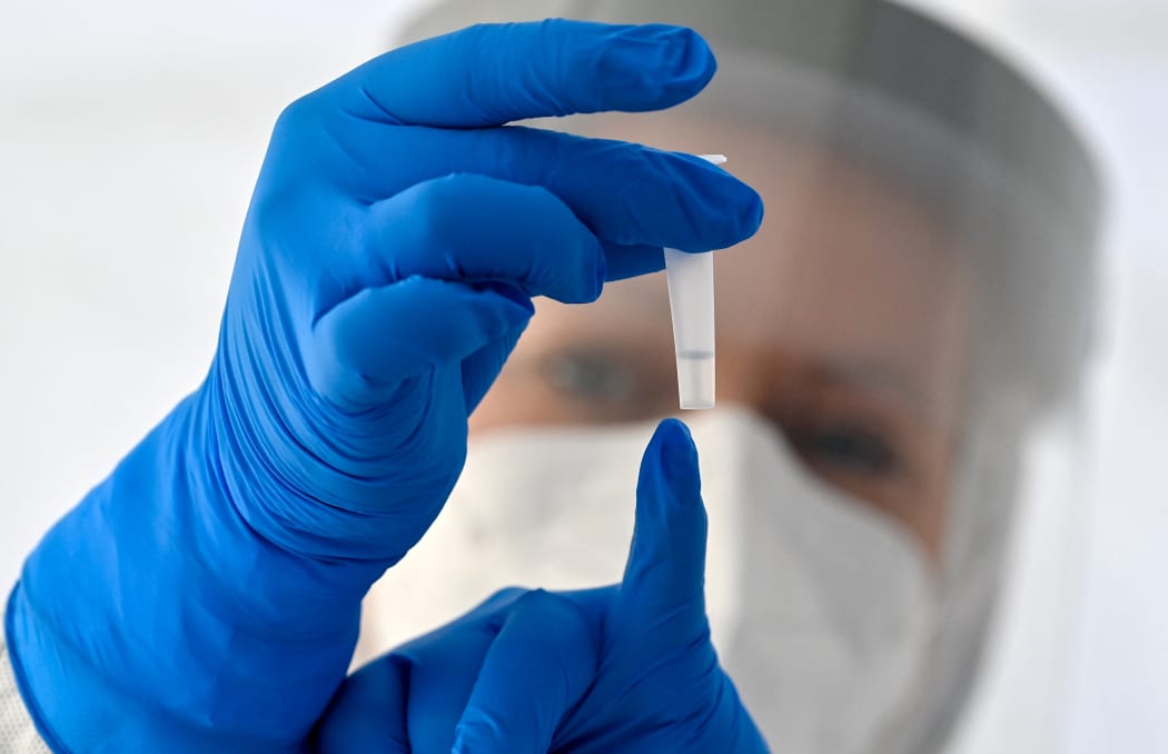 An employee shows a tube with the carrier fluid for a Corona rapid test. F