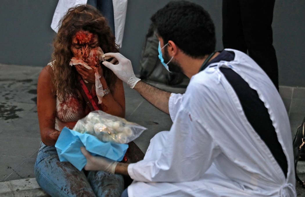 A wounded woman receives help outside a hospital following the explosion
