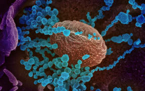 A scanning electron microscope image showing SARS-CoV-2 emerging from the surface of cells cultured in the lab.