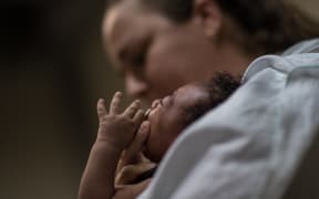 A physiotherapist in Brazil holds a baby suffering from microcephalia.