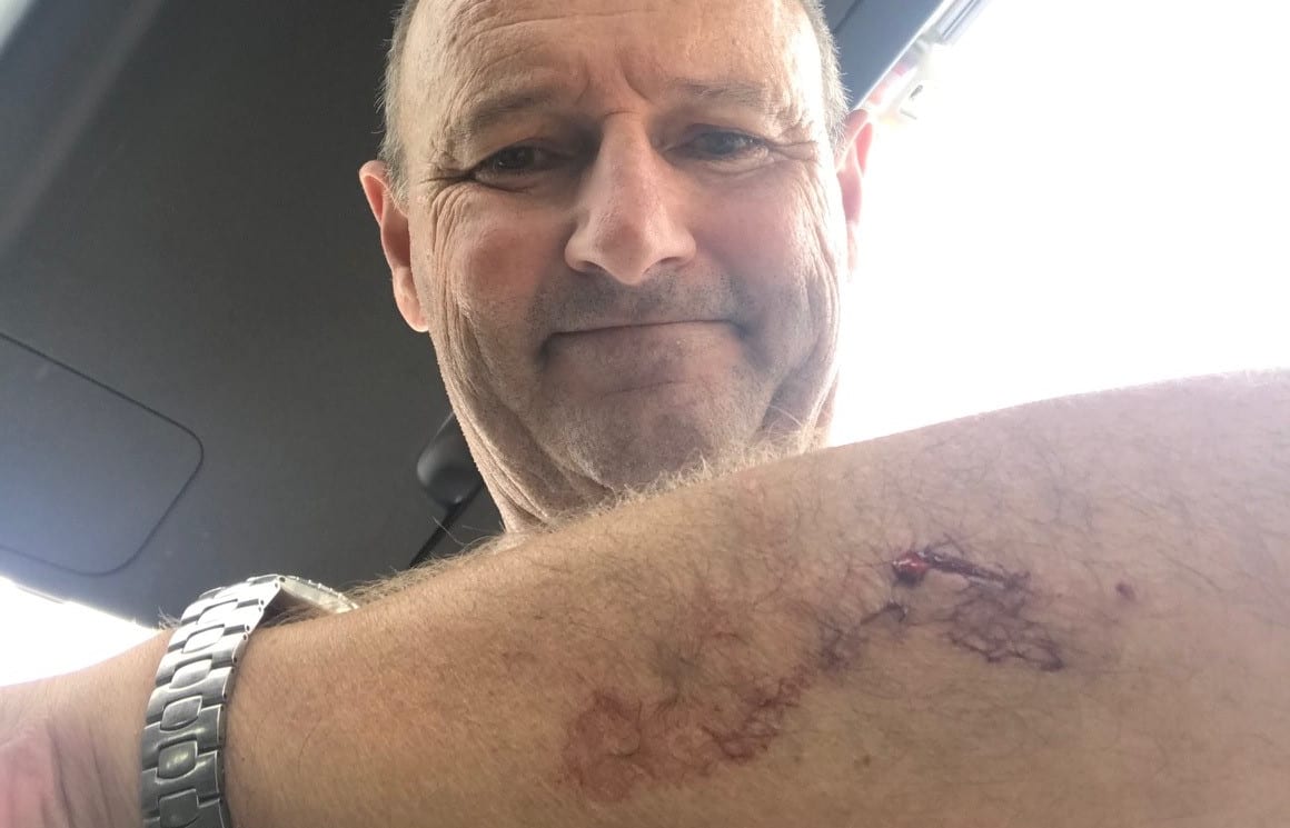 Auckland surfer Nick Minogue was bitten by a Great White shark.
