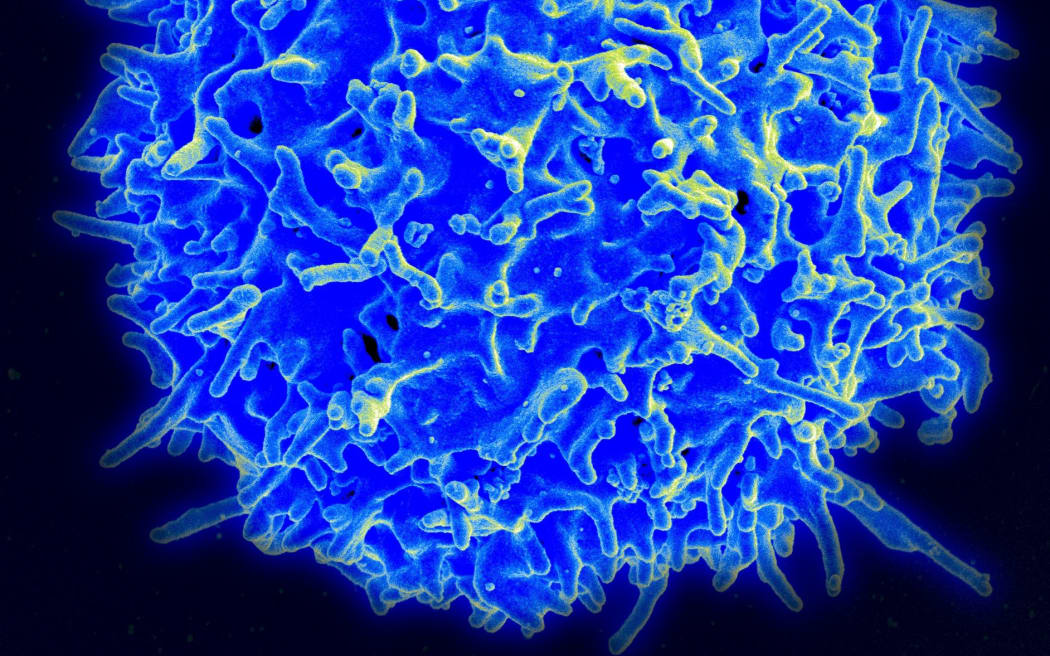 Scanning electron micrograph of a human T lymphocyte (also called a T cell) from the immune system of a healthy donor.