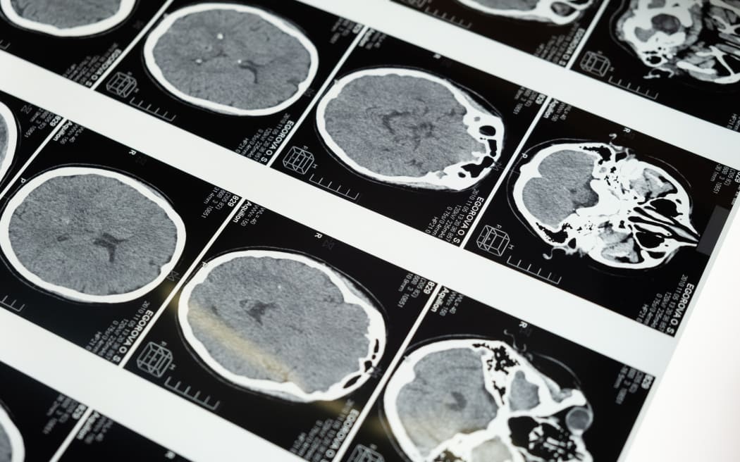 brain scans