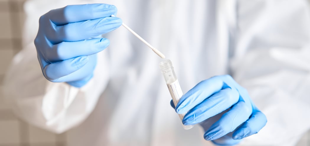 Doctor holding swab test tube for 2019-nCoV analyzing. Coronavirus test. Blue medical gloves and protective face mask for protection against covid-19 virus. Coronavirus and pandemic