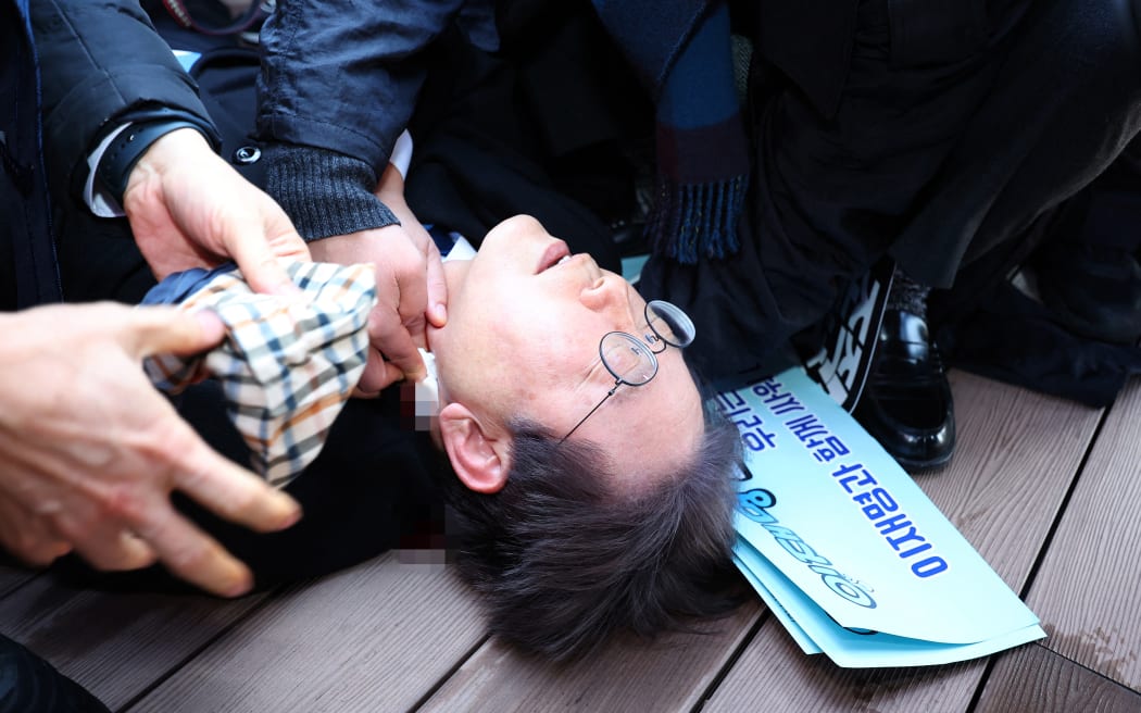 South Korean opposition party leader Lee Jae-myung is attended to after being attacked in Busan on January 2, 2024. South Korean opposition party leader Lee Jae-myung was attacked on January 2, while talking to reporters in the port city of Busan, Yonhap news agency reported. (Photo by YONHAP / AFP) / - South Korea OUT / NO ARCHIVES -  RESTRICTED TO SUBSCRIPTION USE  
 
IMAGES PIXELATED AT SOURCE