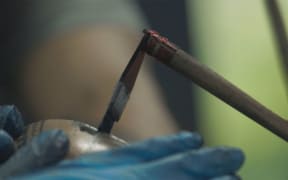 A close-up of the knee being tattooed