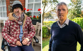 Dave Richards before and after 3D facial reconstruction