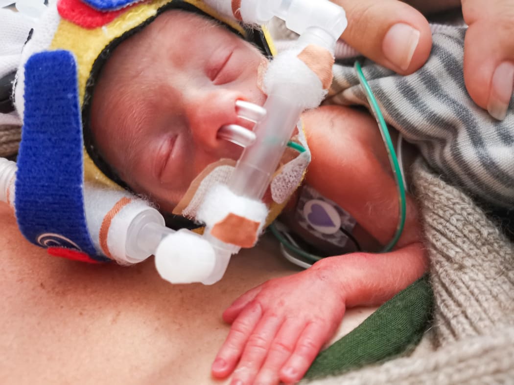 Premature baby Mānuka wearing a cpap breathing device.