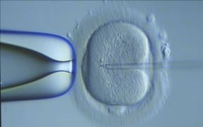 Infertility