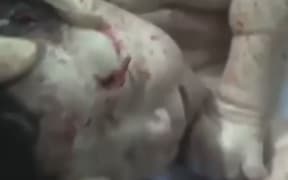 The shrapnel can be clearly seen in the baby's head in the footage posted on YouTube.