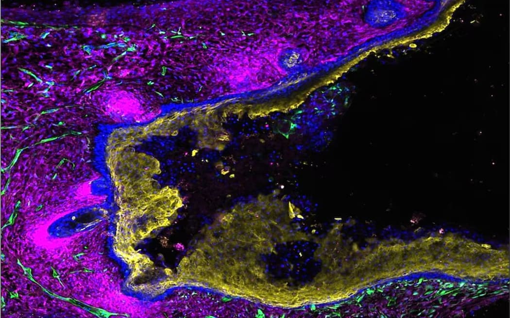 A lab-grown human skin organoid with blood vessels and hair follicles.