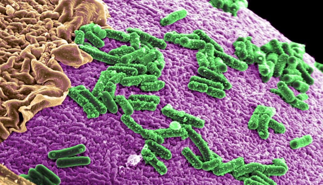 Microbial environment inside the human gut.
