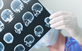 Neurosurgeons