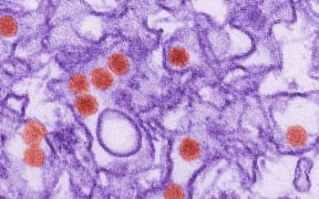 Zika virus