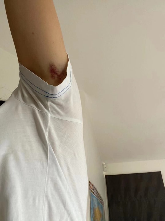 The woman said she’s got a bruise on her left arm when the man tried to forcibly unbuckle the jacket at Waterworld water park in Browns Bay.