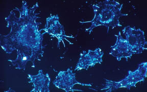 Nanoparticles engineered to image and treat cancer