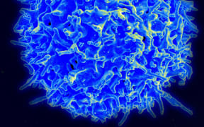 Scanning electron micrograph of a human T lymphocyte (also called a T cell) from the immune system of a healthy donor.