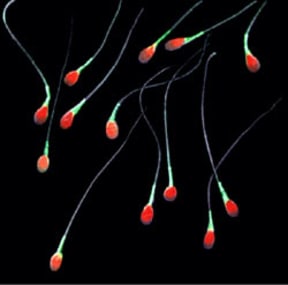 A false colour image of human sperm cells.