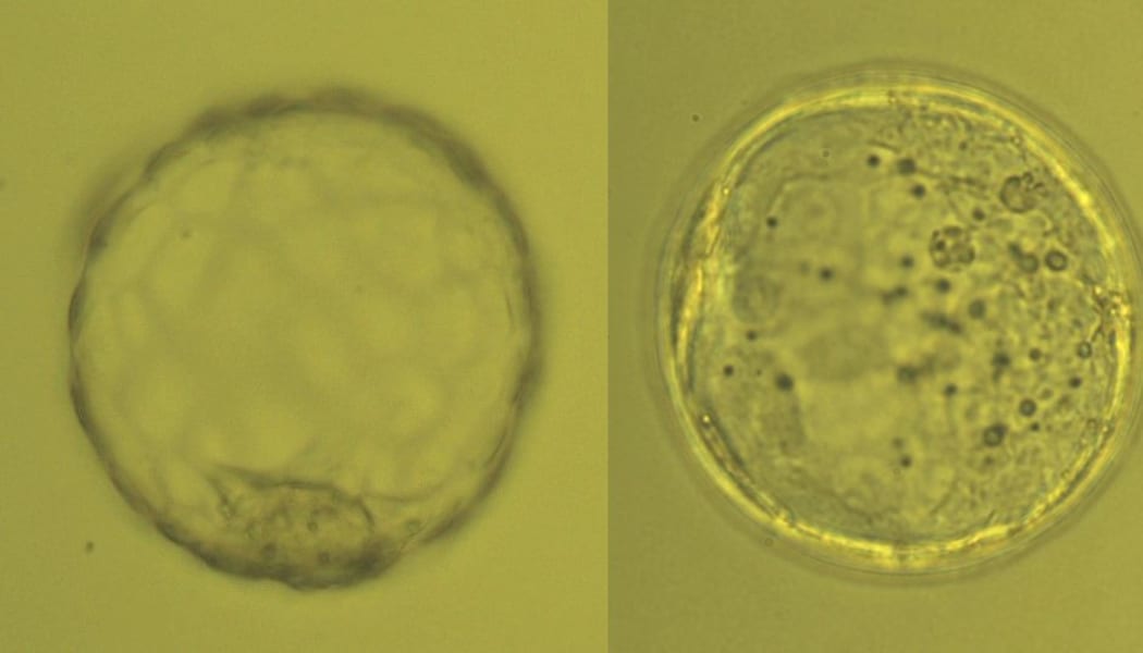 The embryo on the left is a hatched blastocyst of good quality; the one on the right is an expanded blastocyst of poor quality.
