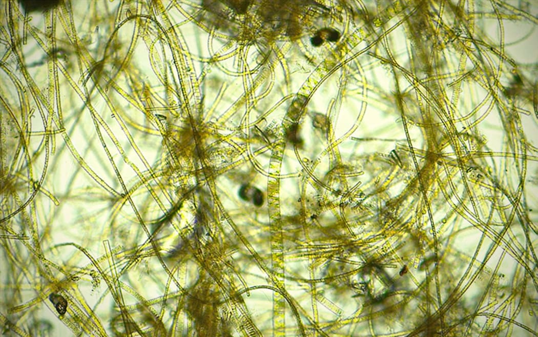 Phormidium is a type of toxic cyanobacteria.