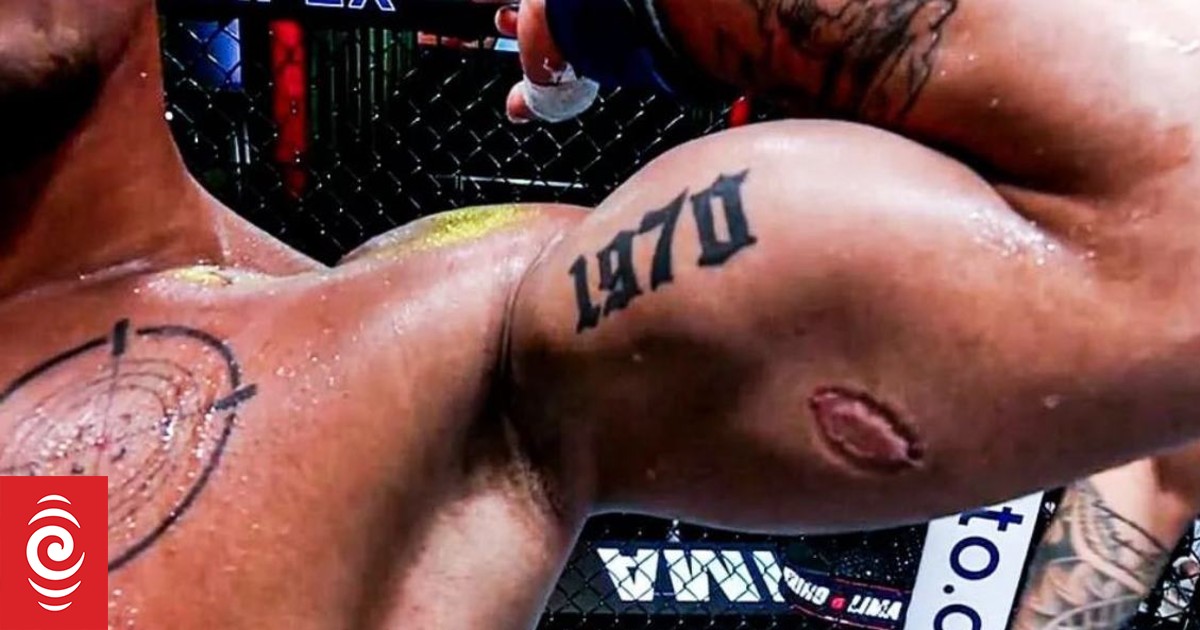 UFC: Bite earns Brazilian fighter $50,000 payday - Vimarsana News