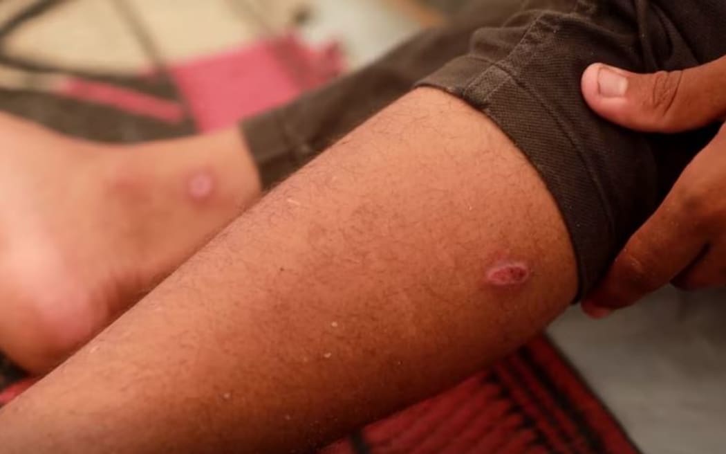 Both boys have similar injuries.