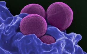 MRSA illustration