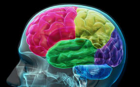 concept image of colored sections of a male human brain.