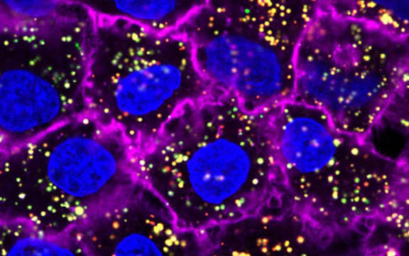 Nanoparticles (yellow) targeting and entering cancer cells (blue