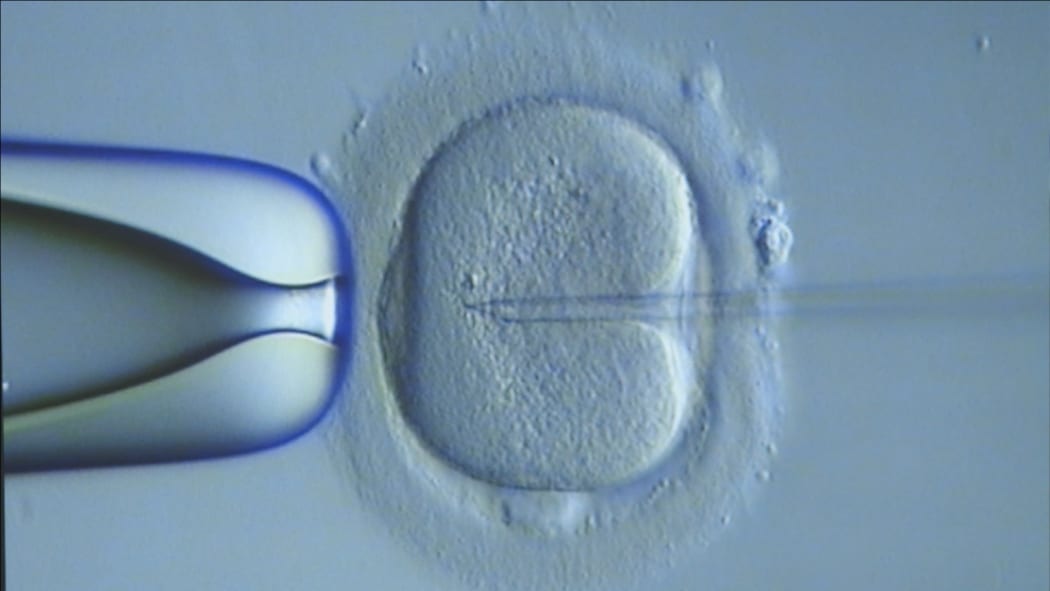 Infertility
