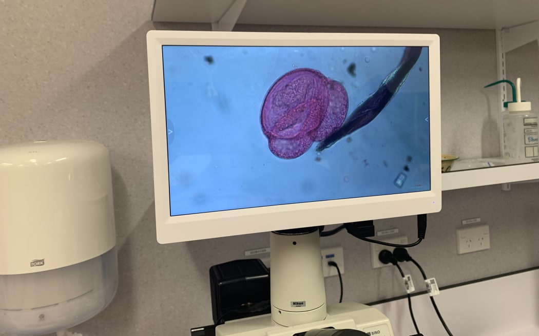 An image of a monitor screen showing a magnified image of a large pink blob with a dark stem.