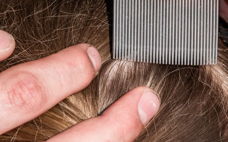 Head lice are getting harder to kill - how to break the nit cycle | RNZ
