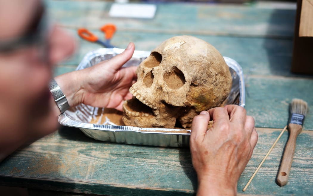 US anthropologist and pathologist, Sherry Fox shows a skull discovered at the excavation site of the first Philistine cemetery ever found on June 28, 2016 in the Mediterranean coastal Israeli city of Ashkelon.