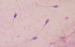 sperm