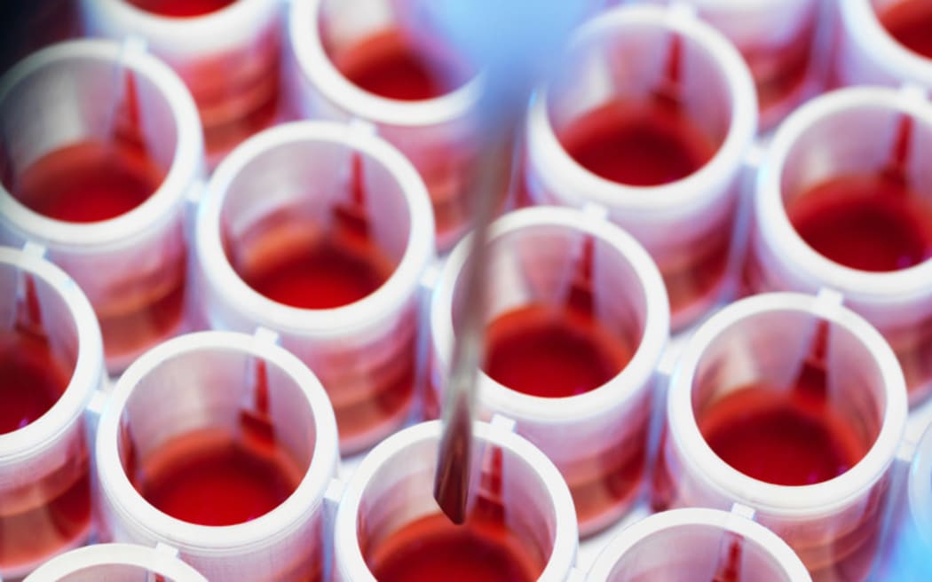 Blood test