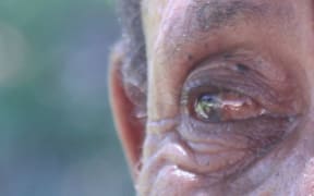 An eye.