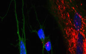 Mitochondrial transfer from primary astrocytes to neurons.