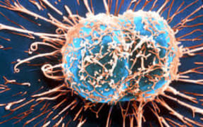 Cancer Cell