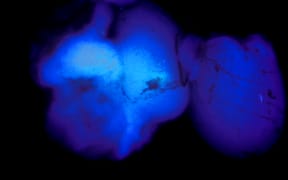 A fish brain fluorescing blue as it has too little oxygen