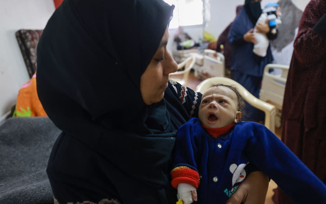 Palestinian children suffering from malnutrition receive treatment at a healthcare center in Rafah in the southern Gaza Strip on March 5, 2024, amid widespread hunger in the besieged Palestinian territory as the conflict between Israel and the Palestinian militant group Hamas continues. (Photo by MOHAMMED ABED / AFP)