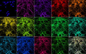 Computer imaging of neuronal synapses in the brain. Conventional images of cell nuclei and two proteins (top row, three images on the left), along with 11 PRISM images of proteins and one composite, multiplexed image (bottom row, right).