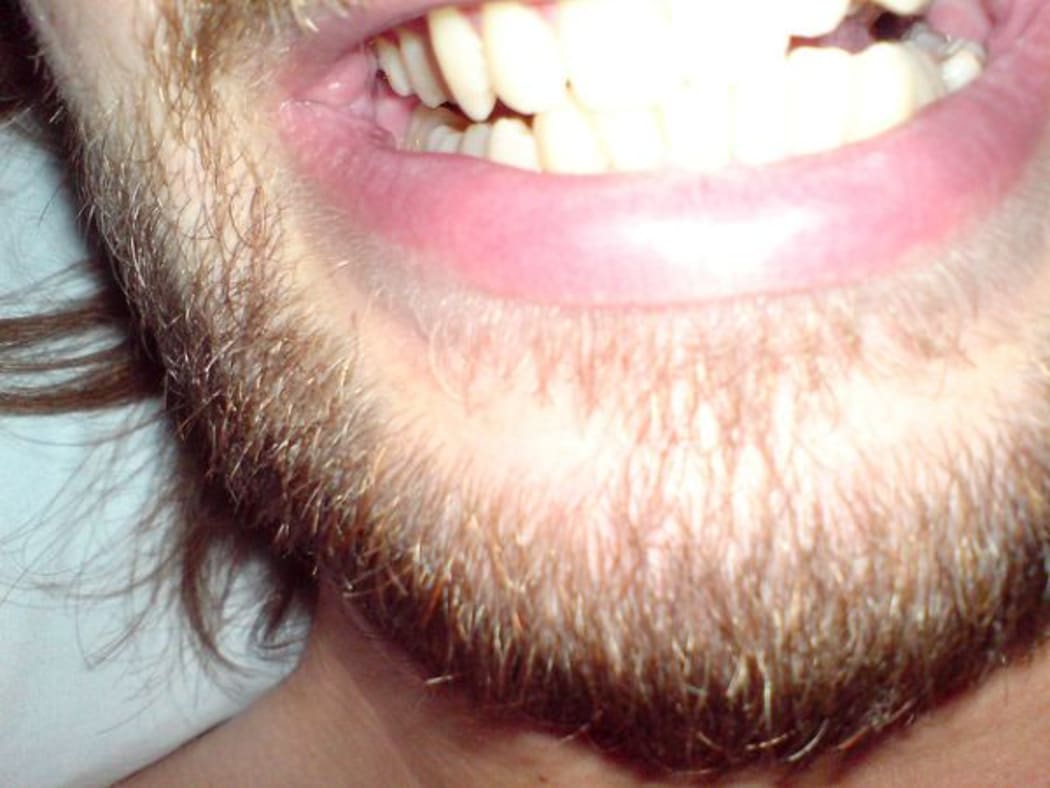 A hairy chin