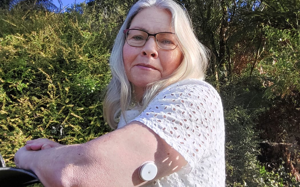 Karen Reed, 54, was diagnosed with type 1 diabetes at 10.