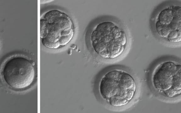 Newly fertilised eggs before gene editing, left, and embryos after gene editing and a few rounds of cell division.