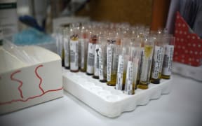 Tests for Zika