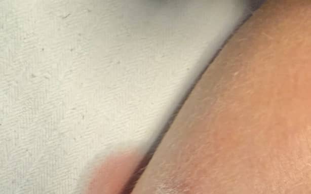 Young Auckland FC fan's leg gashed on way home from semi-final | RNZ