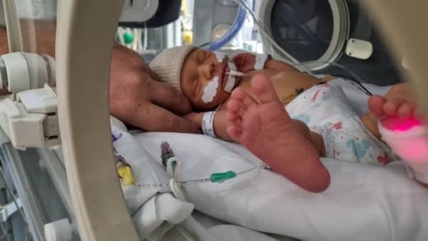 Baby Sophie was born four weeks early and spent time in an incubator.