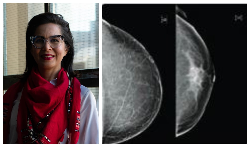 Dr Monica Saini believes New Zealand women should be given more information about the density of their breasts when they get a mammogram.