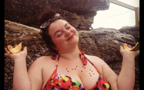 Ally wears a watermelon-patterned bikini