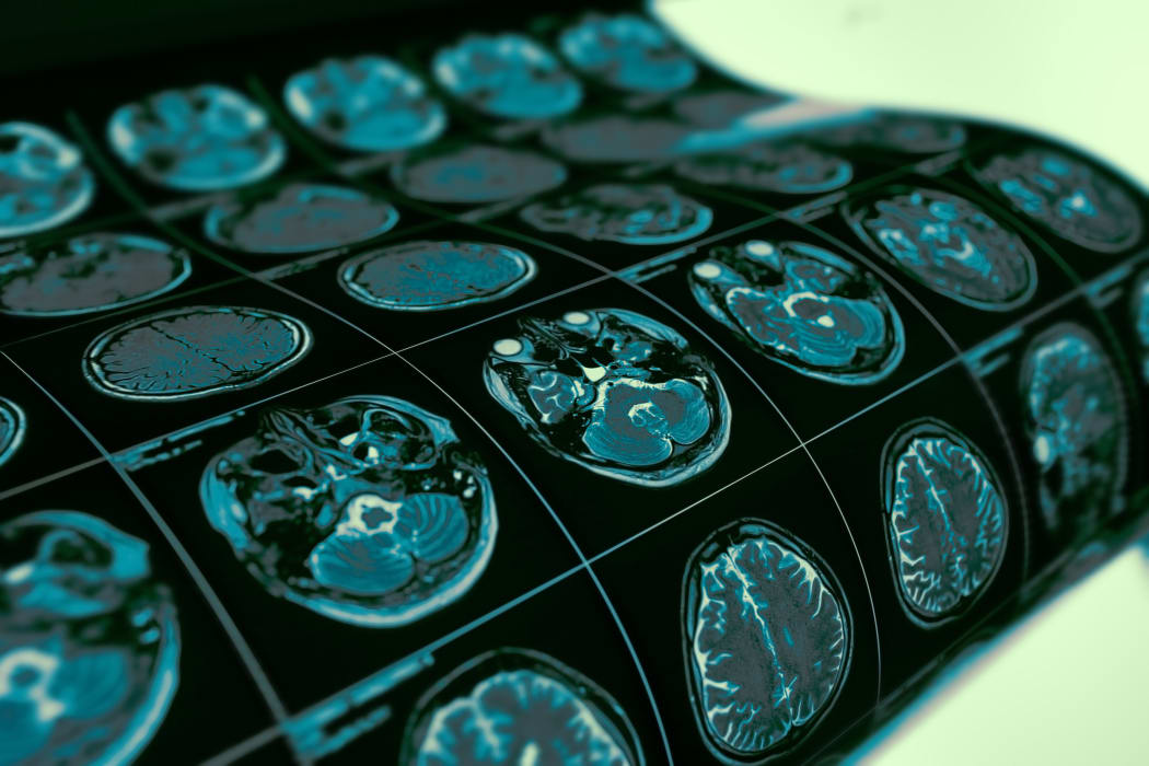 MRI examination film of patient's head as a medical diagnostic background.